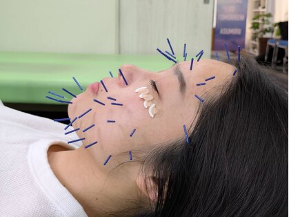 アスミルはり灸接骨院の写真