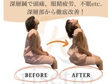 リセット鍼灸院(Risetto鍼灸院)/深層鍼で根本改善！