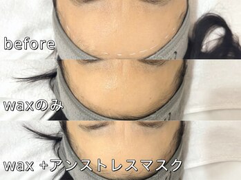 オルド 大阪本町(Ordo)/ワックス +アンストレスマスク