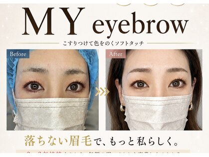 ヴィクトリア アイ(victoriaeye)の写真