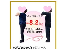 ビオ接骨院 大曽根院/ズボンが履けるように☆