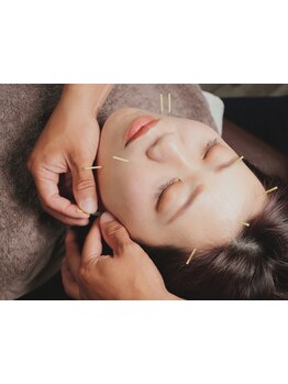 鍼灸施術を受けたい