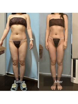 メイ(May)/30代前半 全身痩身