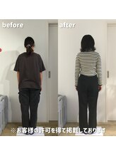 シンプル(Simple.)/美容姿勢整体10回目の変化