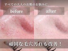 キャロリーヌ 池袋店
