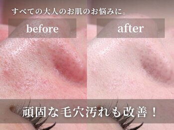 キャロリーヌ 池袋店