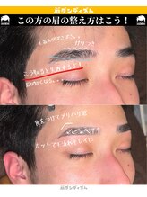 眉ダンディズム 大阪天神橋六丁目店 垂れ眉さん 解消!