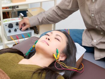 ハリカフェ(HARI CAFE)/リフトアップ美容鍼