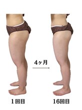 ラニカイ 八代店(Lanikai)/痩身エステ　20代のお客様