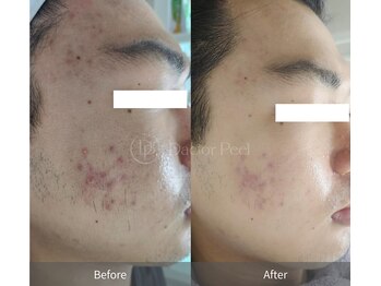 エングロー 錦糸町店(Englow)/