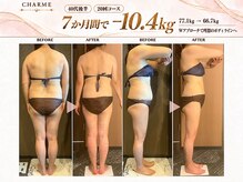 シャルム(charme)の雰囲気（お客様ビフォーアフター★[理想のお身体]への近道！[痩身]）