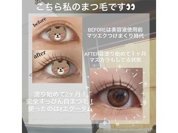 エグータム1ヶ月～2ヶ月の効果☆