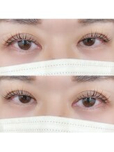 ロゼッタ(Rosetta)/メーテルロッド