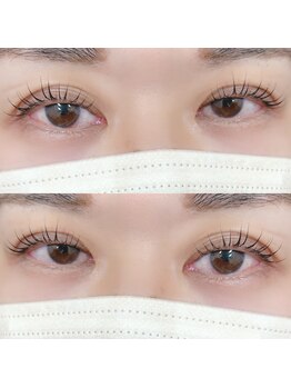 ロゼッタ(Rosetta)/メーテルロッド