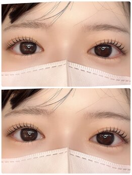 デジール/韓国マツパ