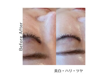 ミークチュール(me couture)/ビフォーアフター 【顔1回】