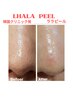 韓国女優肌ララピール&小顔リンパで毛穴レス艶肌美人へ♪スペシャルコース