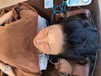 ハリファ鍼灸院 横浜関内院(HariFa鍼灸院)/美容施術