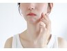 【ニキビ】ニキビ特化フェイシャル¥8800-