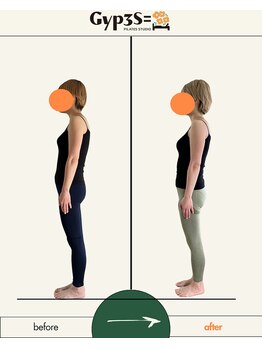 ジップス(Gyp3S=)/数回でこの変化！