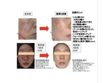 ルルアス(LuLu AS)/