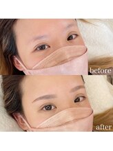 ダリ(Dali)/ハリウッドブロウリフト