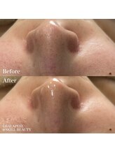 スキル アイラッシュ(SKILL eyelash)/水光肌ララピール♪beforeafter