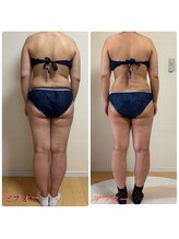 高槻 インサイド(Inside)/50代のお客様　ビフォーアフター