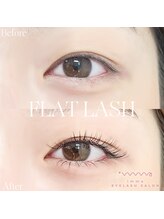 アイマ 北千住(imma)/フラットラッシュ上100本下20本