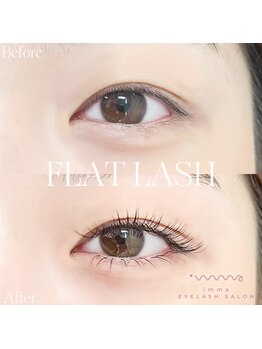 アイマ 北千住(imma)/フラットラッシュ上100本下20本