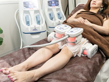 エムズビューティーサロン(M's Beauty Salon)/脂肪冷却【5】