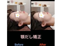 美容矯正サロン レレポノ(LELEPONO)/