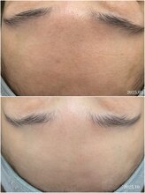 ヒルナム(Heal Nam)/~プロセルセラピーズ~フェイス