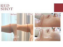 シャンディール(shandeel)/レッドショット