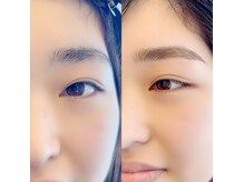 グロウビューティー(grow beauty)/