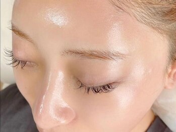 エピック(epic)の写真/《リピート率98%/化粧ノリUP》角質や産毛ざらつきを美容成分WAXで除去！ターンオーバーを促進し肌質改善☆