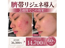 ミラヴィエ(Miravie)