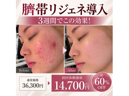 ミラヴィエ(Miravie)の写真