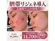 ミラヴィエ(Miravie)の写真