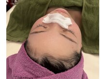 ティアラ(TIARA)/毛穴洗浄のピーリング