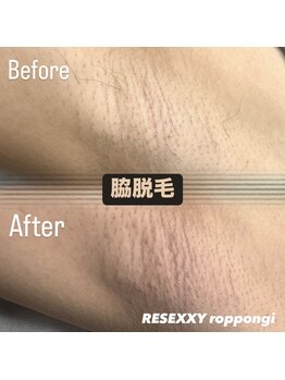 リゼクシー INTERNATIONAL麻布十番 六本木(RESEXXY)/