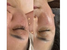 サロンドココリール(salon de cocorire)の雰囲気（臍帯・羊膜幹細胞で毛穴ケア、ニキビケア、たるみ、しみ改善）