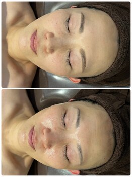 ラナ(Lana)/【ララピール】1回☆