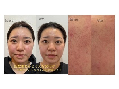 ベル(Belle)の写真