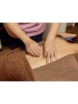 鍼灸施術を受けたい