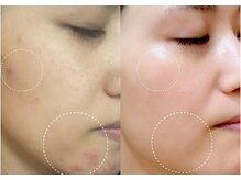 オーシャンブルーム 目黒(OceanBloom)/