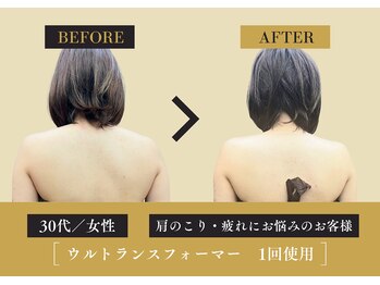 キレイ 筑紫野原田店(KIREI)/30代 肩のこり・疲れにお悩み