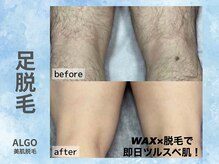 アルゴ 山口宇部店(ALGO)/即日でここまで綺麗に！