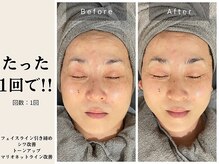 サロン ルイス アディクト(salon Lewis Addict)/ハイアールエフウェーブ