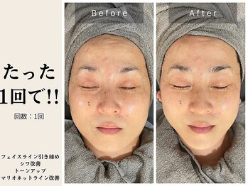 サロン ルイス アディクト(salon Lewis Addict)/ハイアールエフウェーブ